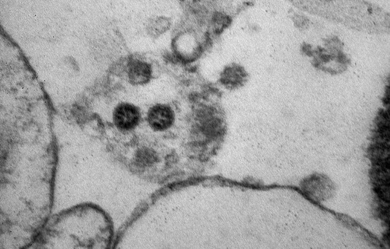 Российские ученые опубликовали фотографии штамма коронавируса Омикрон