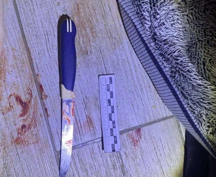 Жительница Черняховска ударила сожителя ножом в пылу ссоры