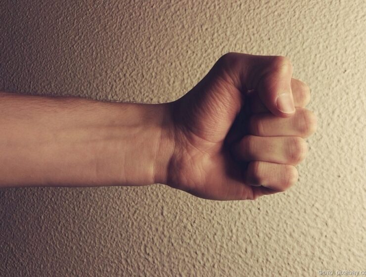 В Калининграде задержан подозреваемый в нанесении тяжких телесных повреждений В Калининграде задержан подозреваемый в нанесении тяжких телесных повреждений