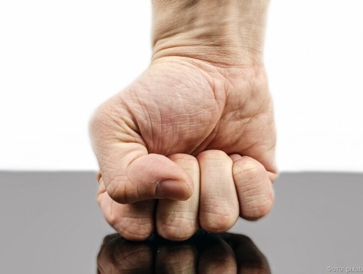 Уличные разборки в Калининграде закончились уголовкой за поломанную челюсть