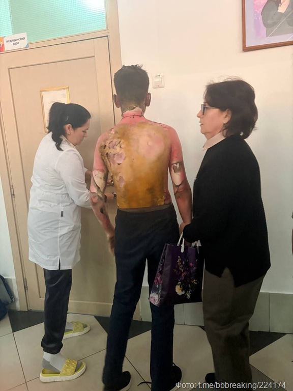 Трагедия в 153-й школе Красноярска: восьмиклассница напала на сверстников с молотком и бензином