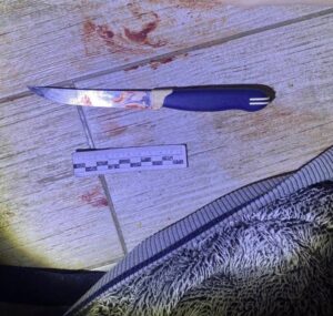 В&nbsp;Калининграде мужчина ударил жену ножом во&nbsp;время застолья