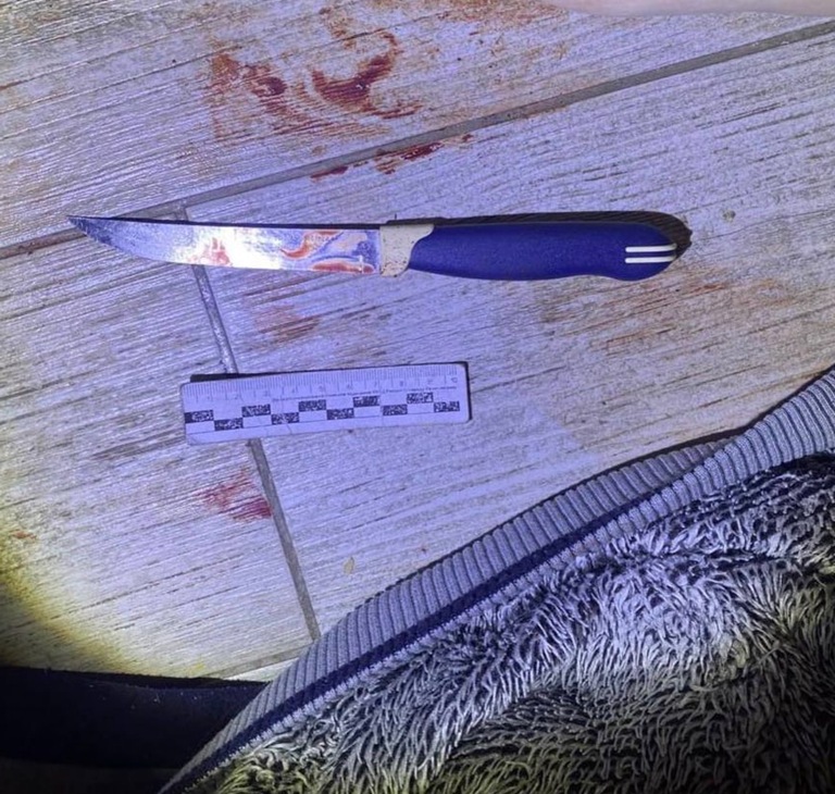 В&nbsp;Калининграде мужчина ударил жену ножом во&nbsp;время застолья